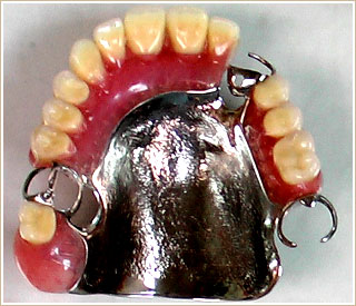旧い義歯