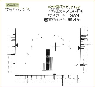 オクルーザーのデータ　治療前