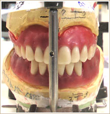 咬合器に模型を装着して、義歯を合わせて確認している写真